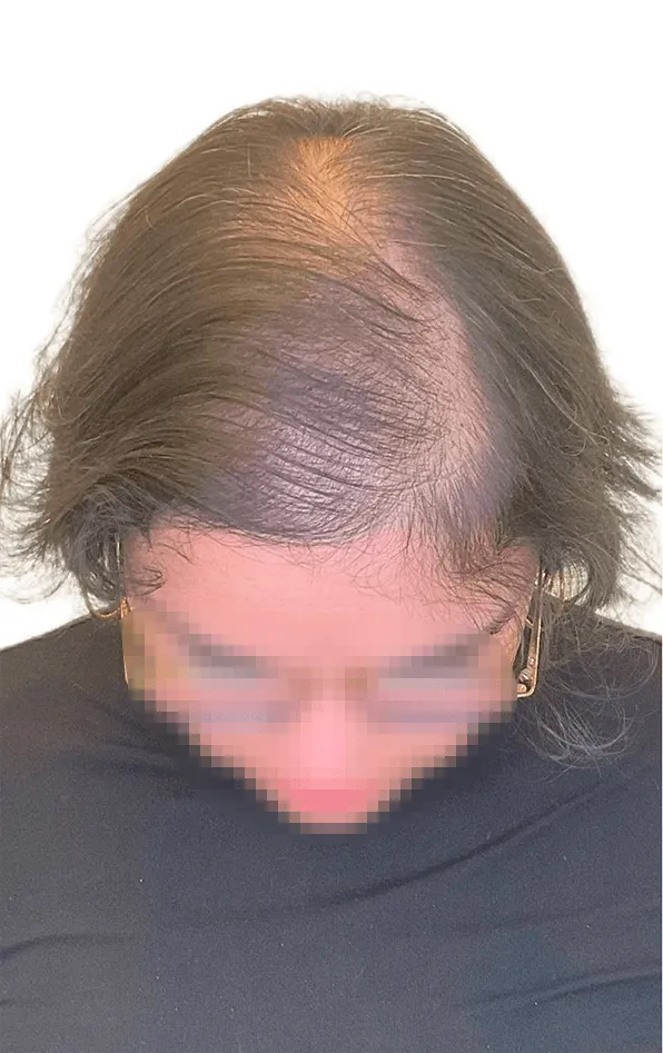 Antes