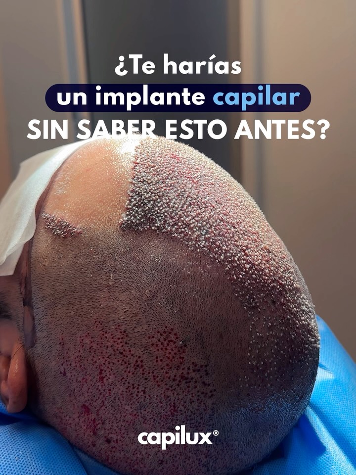 UN CAMBIO DE IMAGEN CON EXCELENTE RESULTADO EMPIEZA POR UNA BUENA ASESORÍA.✔️
